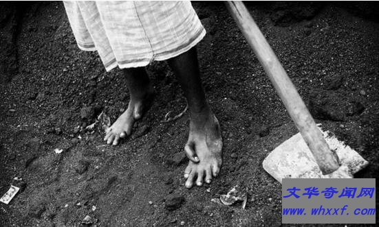 日本核辐射下的变异人