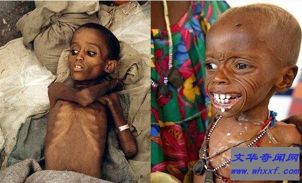 世界上最穷的国家排名